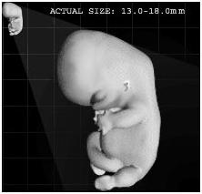Human embryo at 48 days